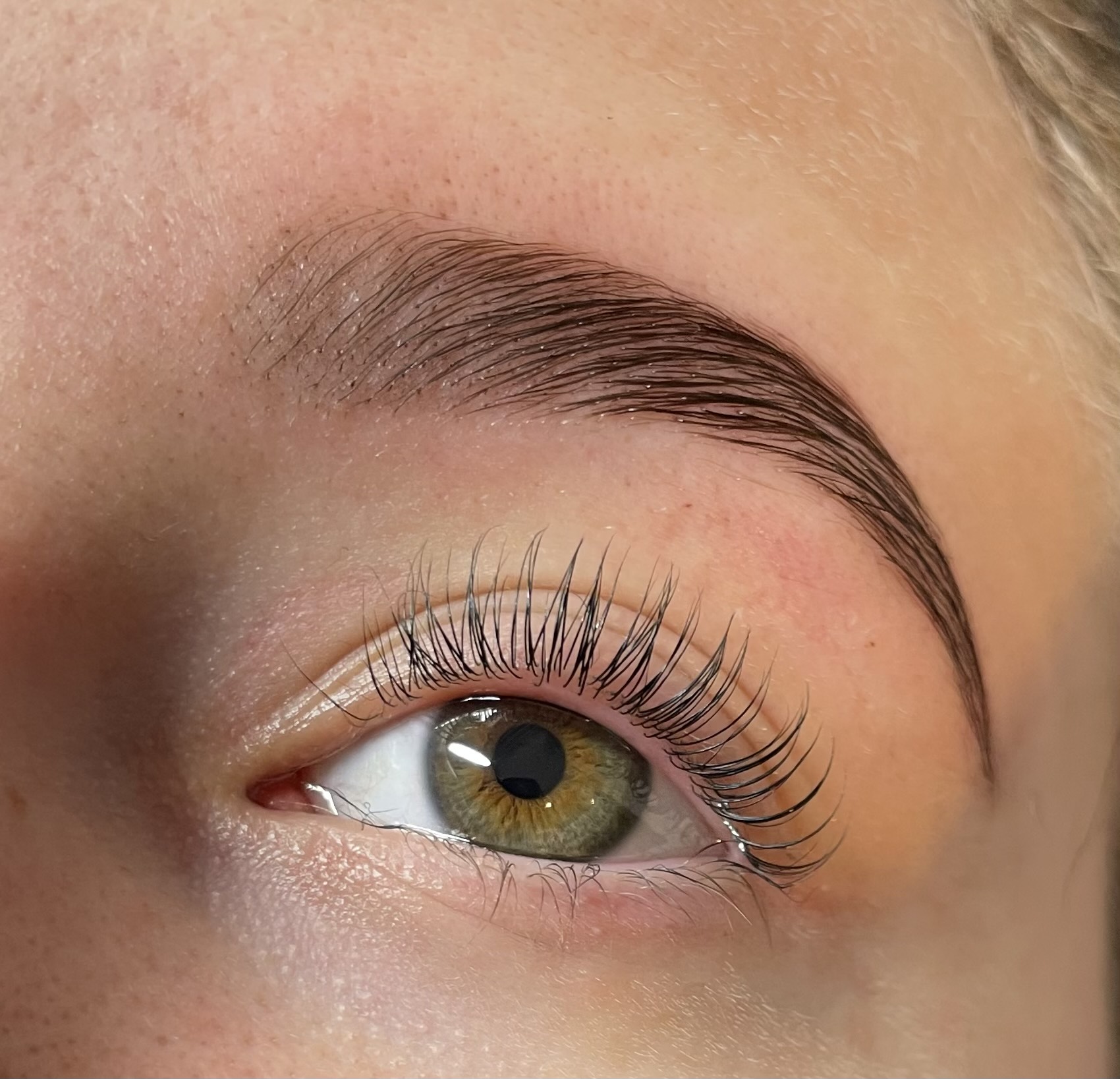 Ögonbryn efter en browlift behandling 